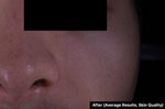 SkinCeuticals P-TIOX Cream clinical results